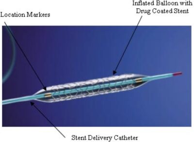 Drug-Eluting Resorbable Scaffold